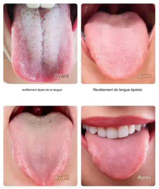 Gratte-langue 🦷 Formula™ Tongue Cleaner + Brosse à Dents en Bambou Naturel Antibactérienne OFFERTE 🎁