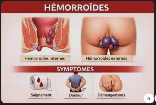 Hémorroïde: Programme Confort 14 jours