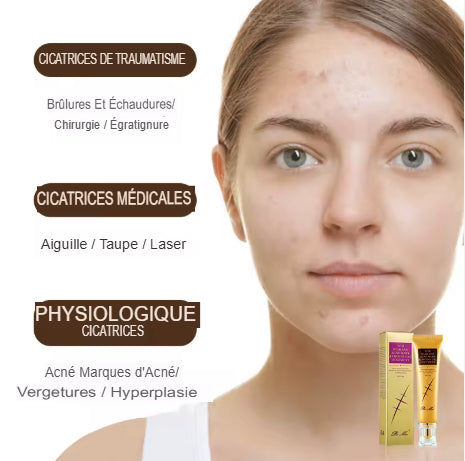 🧴 Peimei Skin Repair Cream – Dites adieu aux cicatrices, redonnez vie à votre peau !